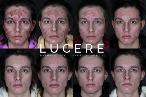 Foto Lucere Dermatology and Laser Clinic